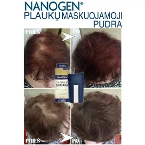 Nanogen Hair Fibres (15g. / 30g.)